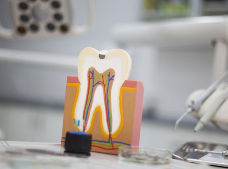 Smiling senior patient — pain-free after her root canal treatment